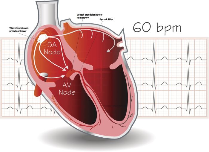 Co jest przyczyną arytmii serca?